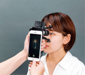 「MS1モバイルスリットランプ」は遠方の眼科医と連携できる、遠隔医療に役立つモバイルデバイス
