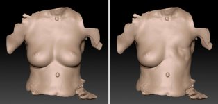 3Dデータに落とし込み、残った乳房の形を反転させて設計図をつくっていく