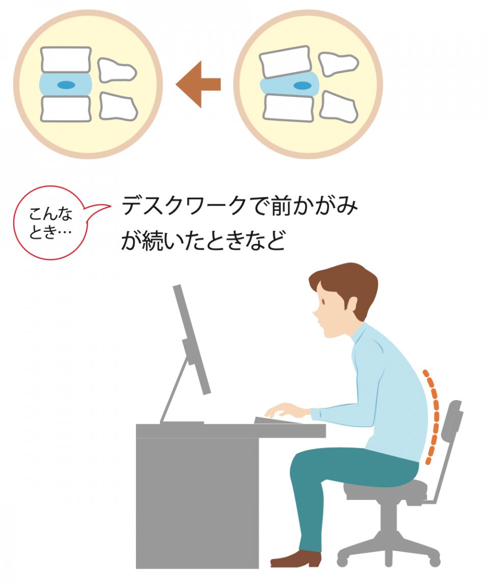 テーマ別誌上セミナー 特集2 腰痛は 自分でコントロールできる 日商 Assist Biz